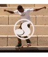 DVS